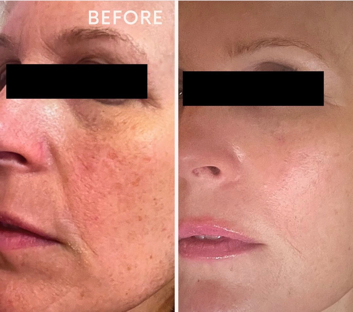 (Second Presale) Spalina Italian Glow Treatment Series