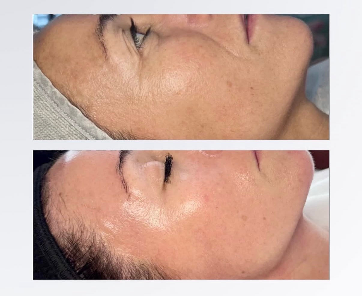 (Second Presale) Spalina Italian Glow Treatment Series
