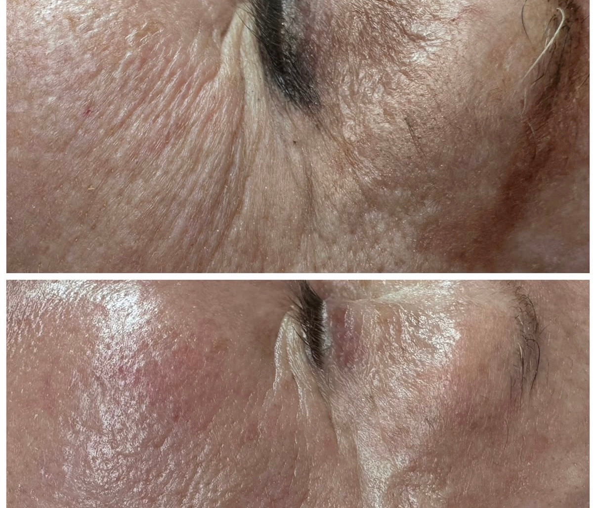 (Second Presale) Spalina Italian Glow Treatment Series