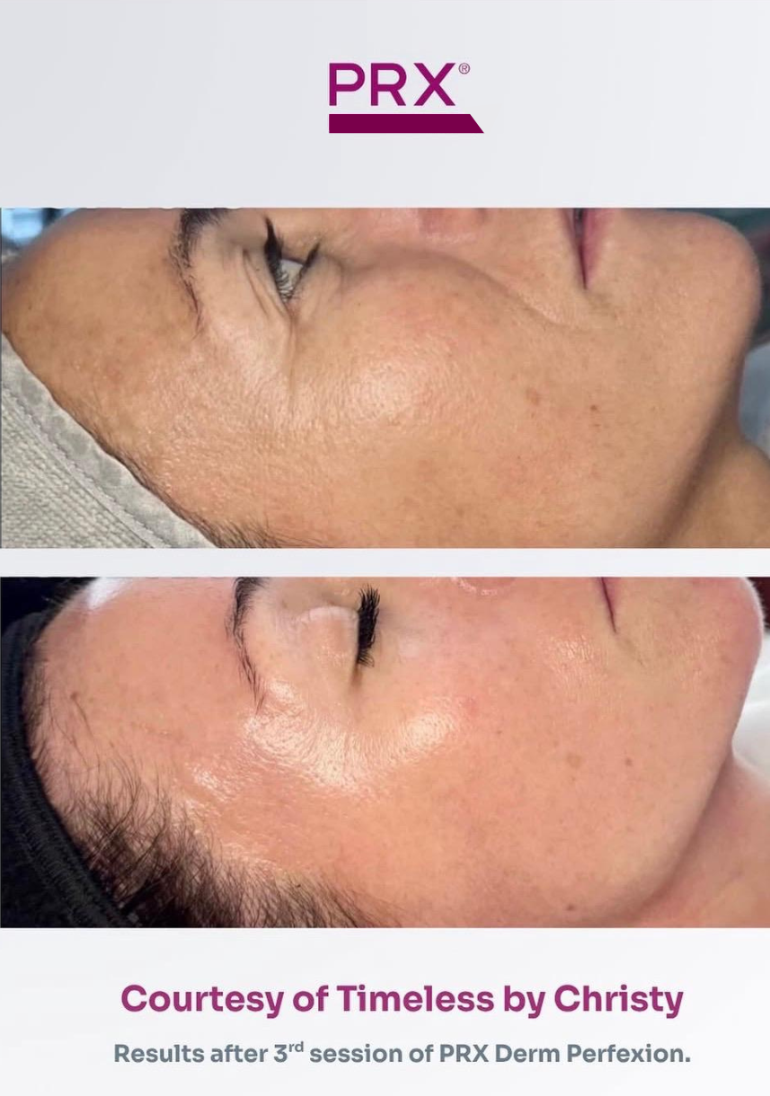 (Second Presale) Spalina Italian Glow Treatment Series